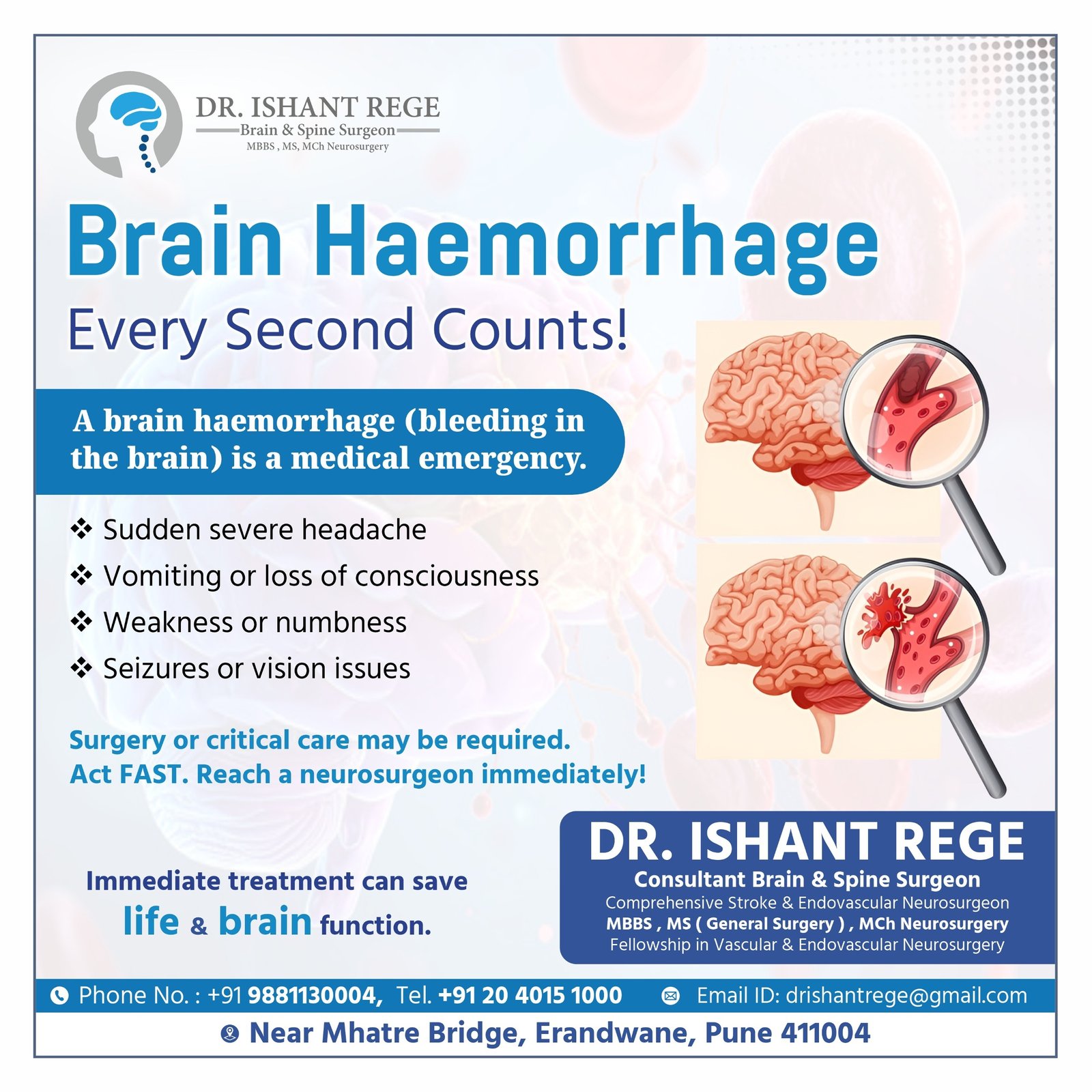 Brain Haemorrhage: Don't Ignore the Warning Signs